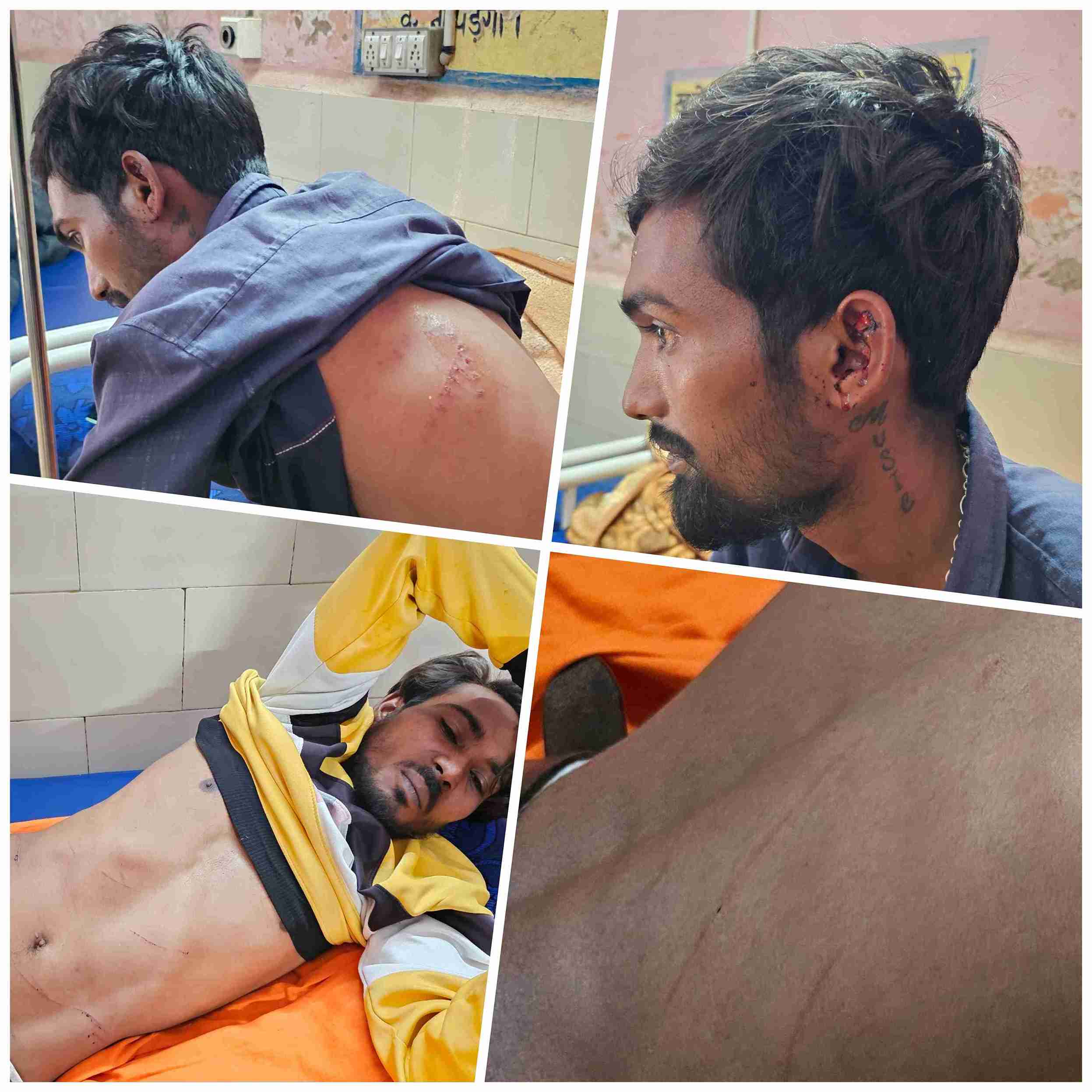 खैरागढ़. दिलीपपुर में दो पक्षों में खूनी संघर्ष: तीन गंभीर रूप से घायल, टंगिया, ब्लेड व चैन से हुए हमले