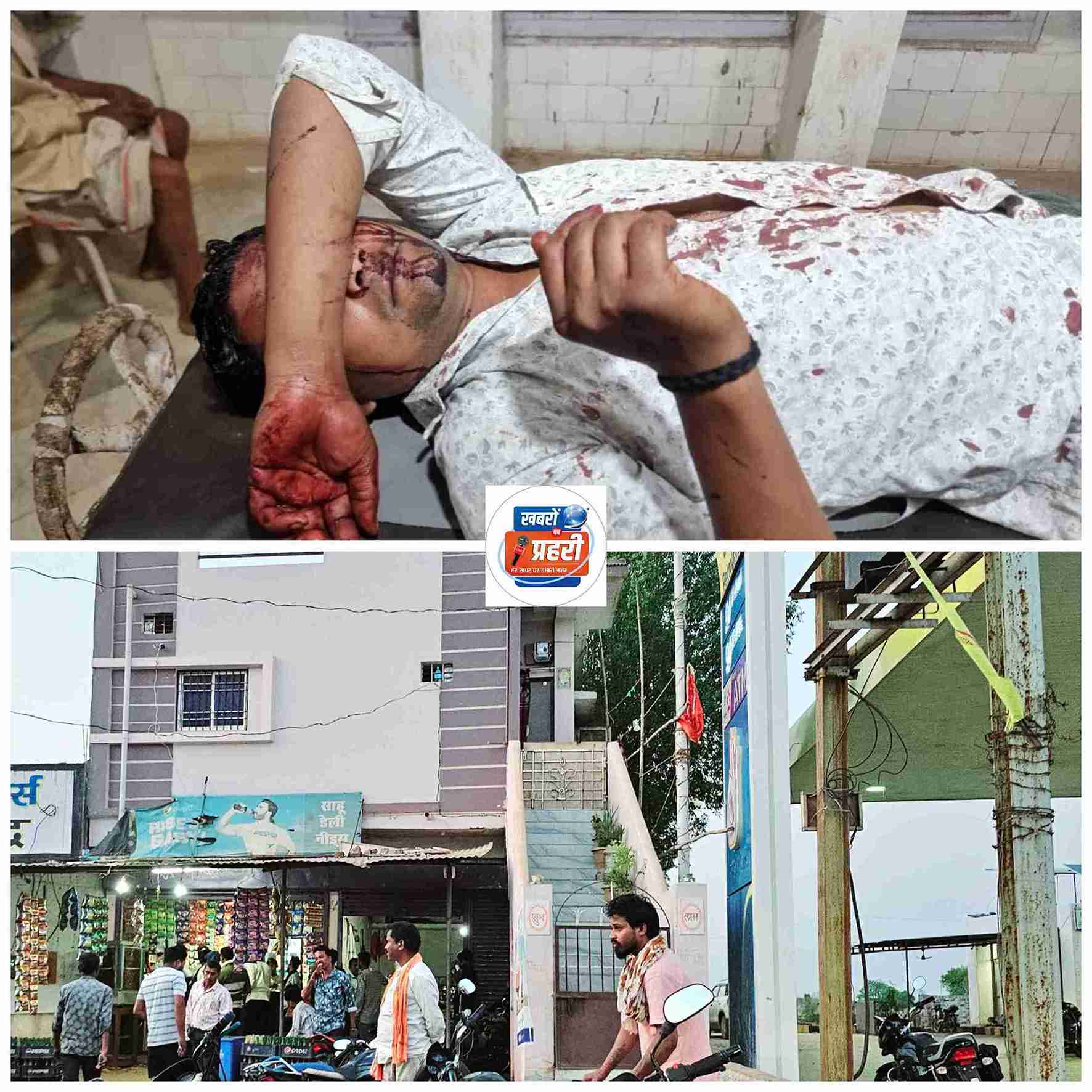 खैरागढ़. दुकान में सामान लेने गए व्यक्ति से दुकानदार ने की मारपीट, जान से मारने की दी धमकी